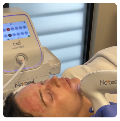 Bella Tixel Image (1)-1